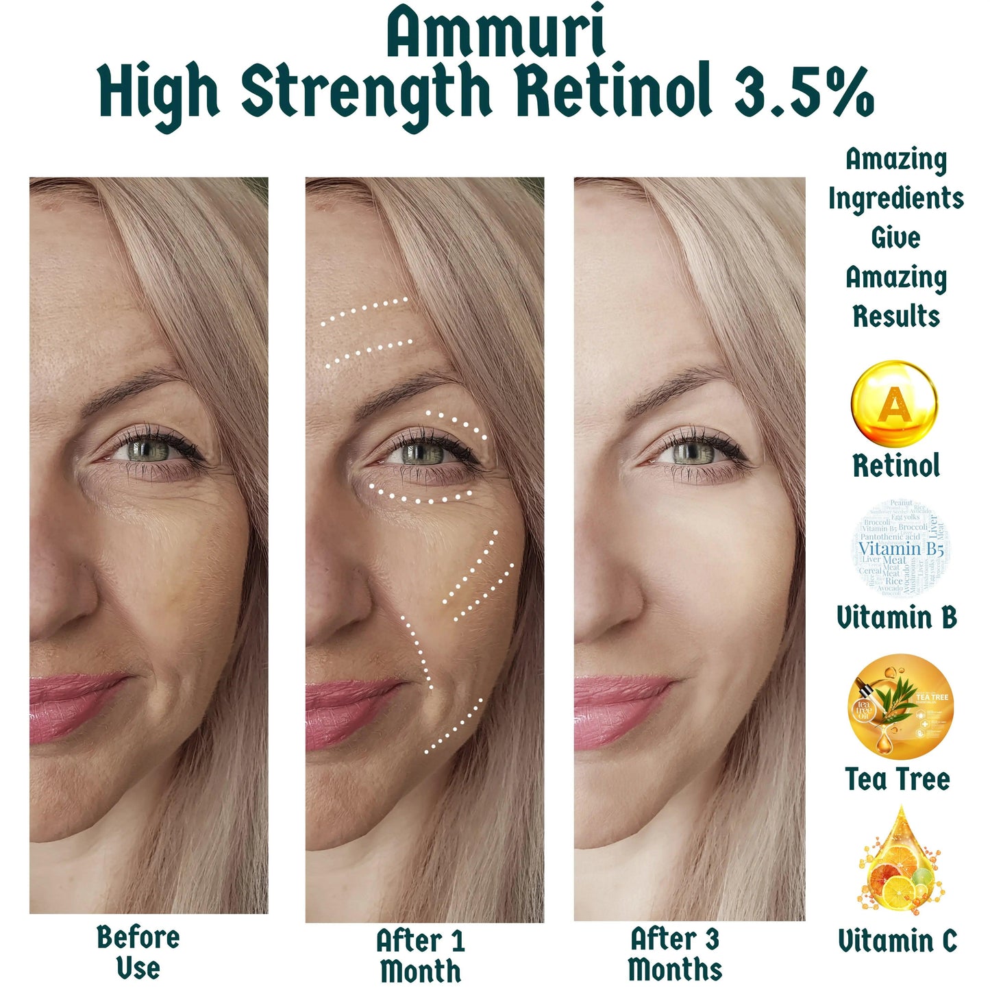 Ammuri High Strength Retinol 3.5% Serum for Anti-Aging