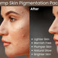 Ammuri Pigmentation Skincare Gift Set - Brightening Dark Spot Treatment Bundle