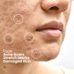 Ammuri Bioactive Snail Repair Serum Anti-Aging Organic