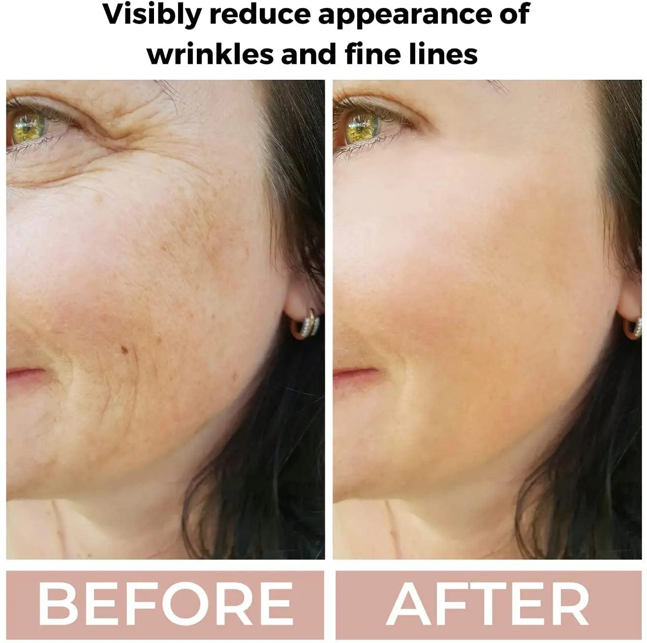 Ammuri 3.5% Retinol High Strength Face Serum – Anti-Ageing Formula