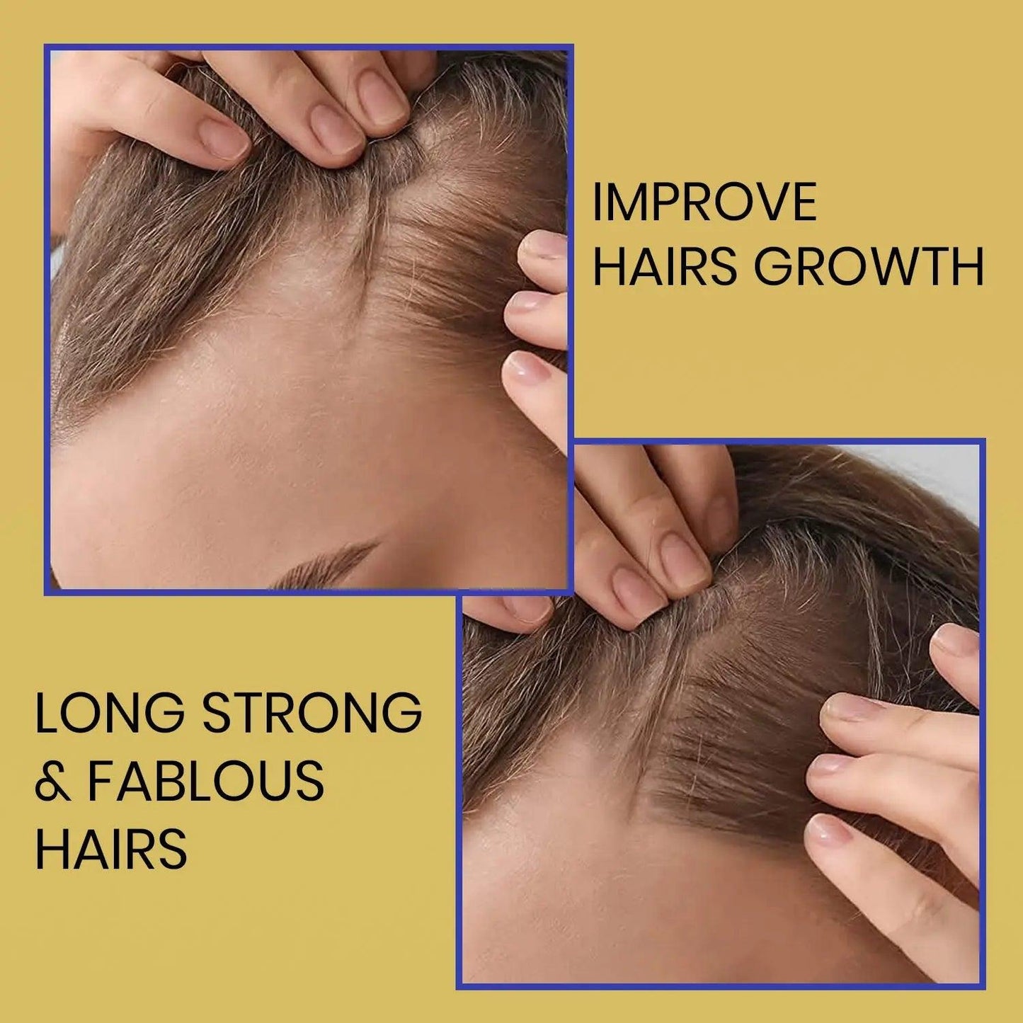 Ammuri Biotin Shampoo - DHT Blocker for Thicker Hair Growth Treatment 473ml Set Of 2