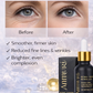 Ammuri Retinol 2.5% Face Serum - Retinol Serum with Vitamin C and Niacinamide