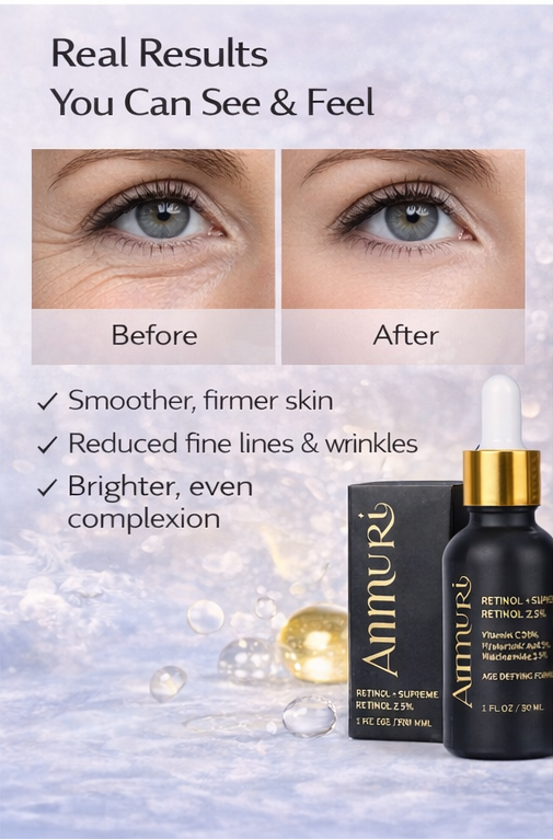 Ammuri Retinol 2.5% Face Serum - Retinol Serum with Vitamin C and Niacinamide