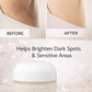 Ammuri Intense Skin Lightening Cream